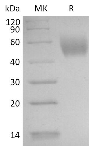 Recombinant Human IL-17RD (C-6His)