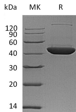 Recombinant Human DHS (C-6His)