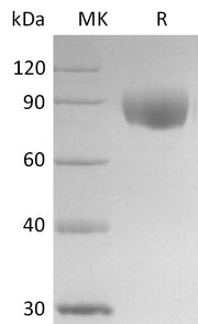 Recombinant Human IL-17RD (C-Fc)