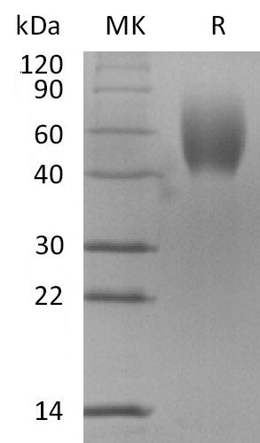 Recombinant Mouse IL-17RD (C-6His)