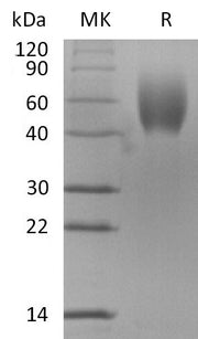 Recombinant Mouse IL-17RD (C-6His)
