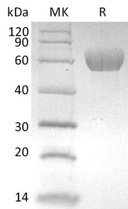 Recombinant Human MAdCAM-1 (C-6His)