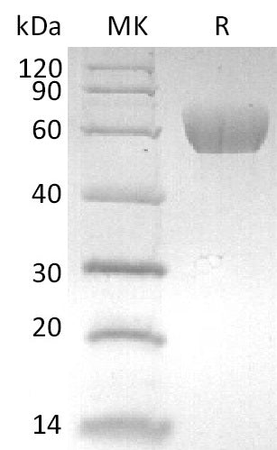 Recombinant Human MAdCAM-1 (C-6His)