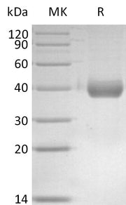 Recombinant Mouse IL-17RB (C-6His)