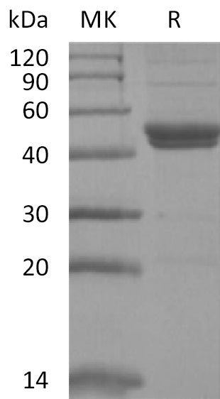 Recombinant Mouse IL-11RA (C-6His)
