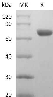 Recombinant Human EphA8 (C-6His)