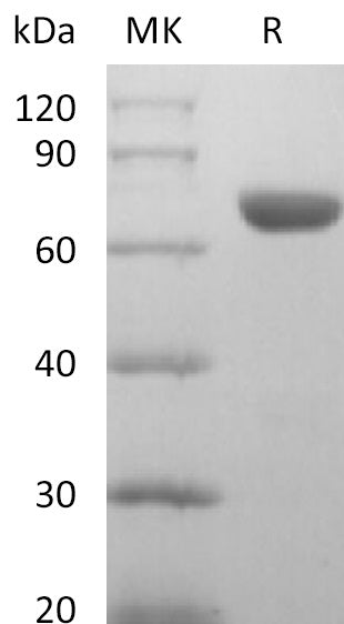 Recombinant Human EphA8 (C-6His)
