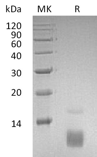 Recombinant Human CCL5