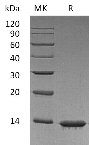 Recombinant Human Leptin
