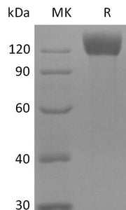 Recombinant Mouse APN Protein (C-6His)