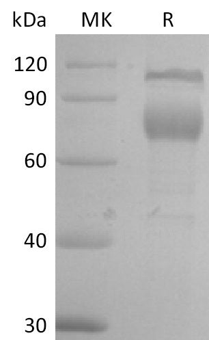 Recombinant Mouse IL-2RB (C-Fc)