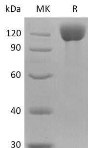 Recombinant Human APN Protein (C-6His)