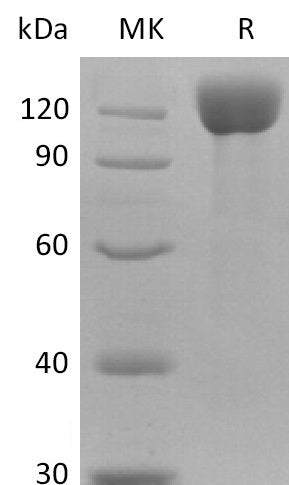 Recombinant Human APN Protein (C-6His)