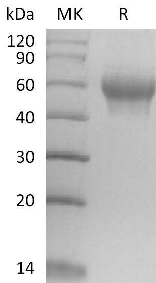 Recombinant Mouse IL-6RA (C-6His)