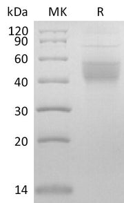 Recombinant Mouse IL-2RB (C-6His)
