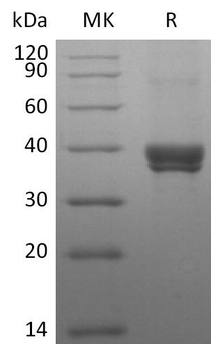 Recombinant Human CD299 (N-8His-Flag)