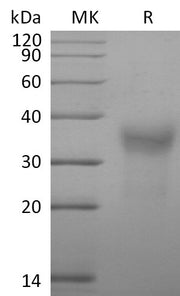 Recombinant Cynomolgus CD7 (C-6His)