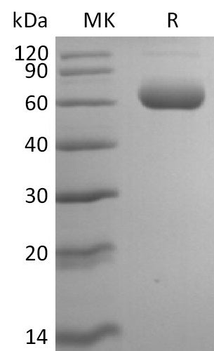 Recombinant Mouse Siglec-F (C-6His)