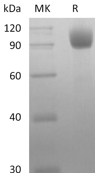 Recombinant Mouse ACE-2 (C-10His)