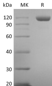 Recombinant Human Tie-2 (C-6His)