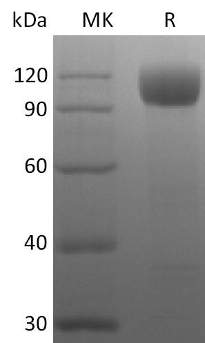 Recombinant Rhesus Macaque ACE-2 (C-10His)