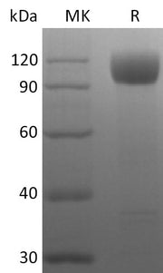 Recombinant Rhesus Macaque ACE-2 (C-10His)