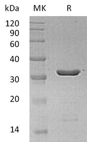 Recombinant Human LGALS8