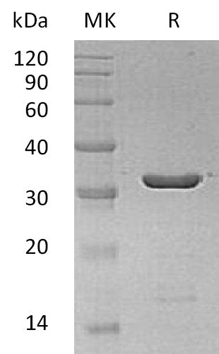 Recombinant Human LGALS8
