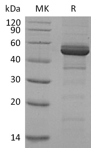 Recombinant Human TACI (C-Fc)