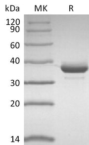 Recombinant Human CD81 (N-FC)