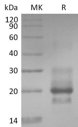 Recombinant Human TRAIL R1 (C-6His)