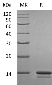 Recombinant Human CSTA (N-6His)