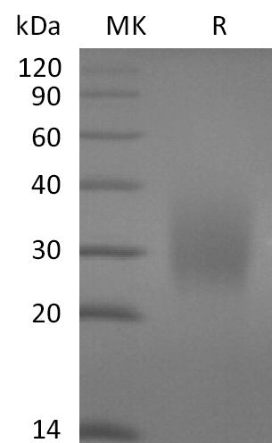 Recombinant Human CD79A (C-6His)