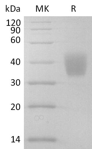 Recombinant Mouse IL-4RA (C-6His)