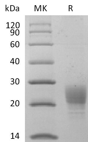Recombinant Cynomolgus PVRIG (C-6His)