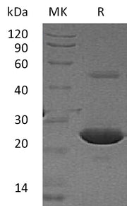 Recombinant Human APT-1 (N-6His)