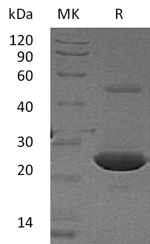 Recombinant Human APT-1 (N-6His)