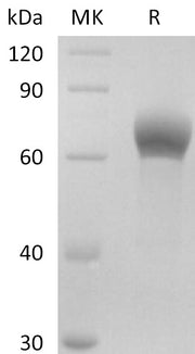 Recombinant Human DKK-1 (C-Fc)