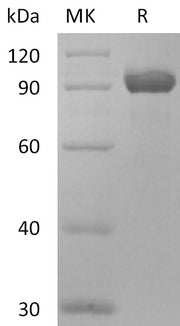 Recombinant Human NPR3 (C-Fc)