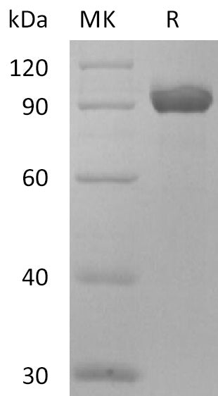 Recombinant Human NPR3 (C-Fc)