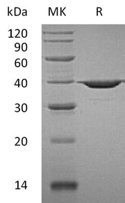 Recombinant Human APE