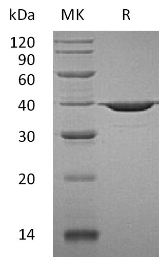 Recombinant Human APE