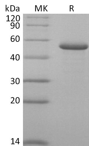 Recombinant Human RCN2 (C-6His)