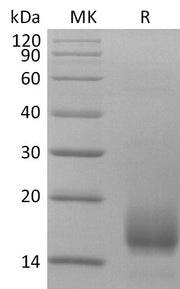 Recombinant Human CD59 (C-6His)