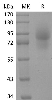 Recombinant Human CD68 (C-Fc)