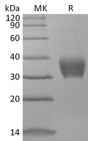 Recombinant Mouse BTNL4 (C-6His)