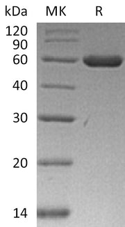 Recombinant Human ARRB1 (C-6His)