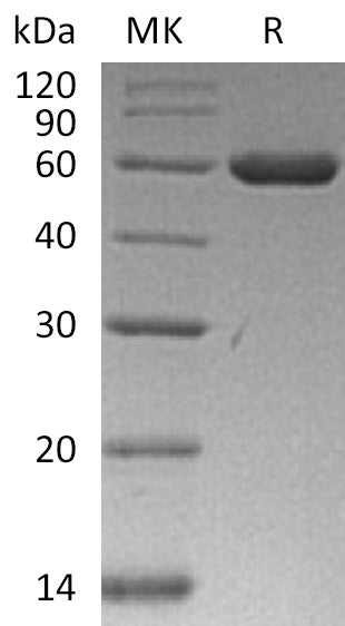 Recombinant Human ARRB1 (C-6His)