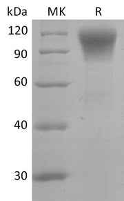 Recombinant Human CD45R0 (C-6His)
