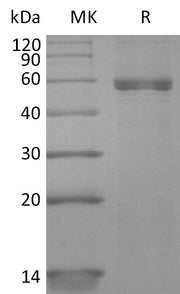 Recombinant Human HLA-A*0201 NY-ESO-1 complex Protein (C-10His)